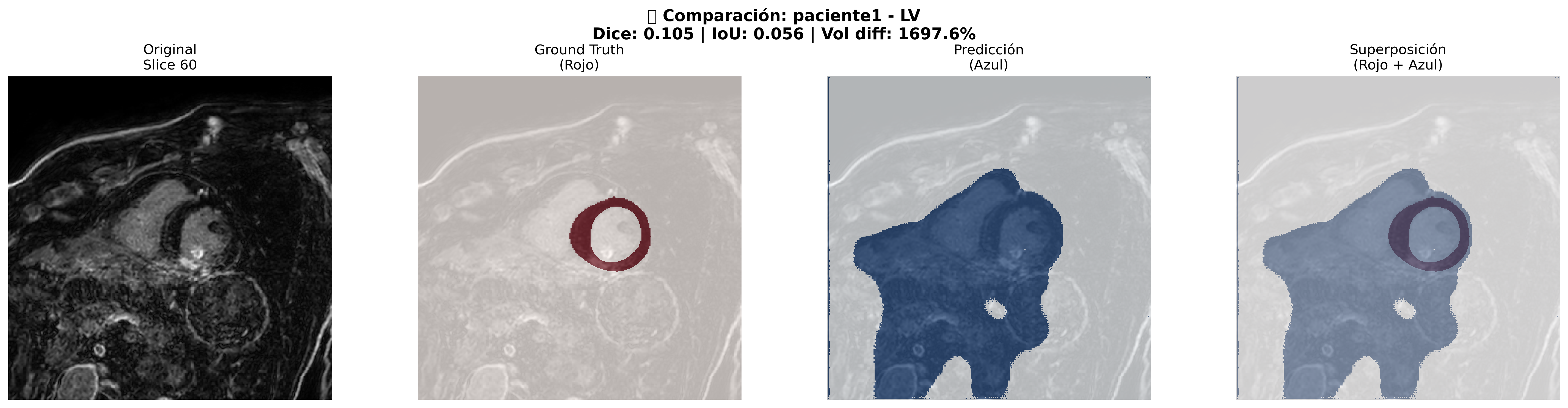 Comparación Adicional - Paciente 1